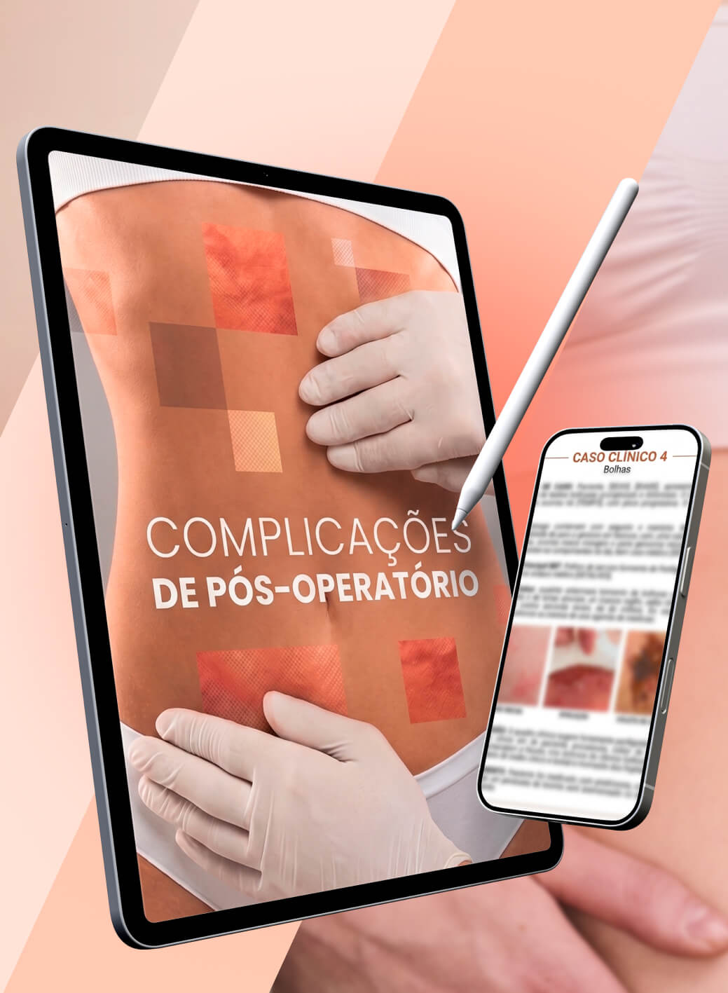 capa complicacoesa ()